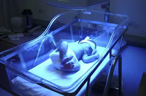 Jaundice-in-the-newborn